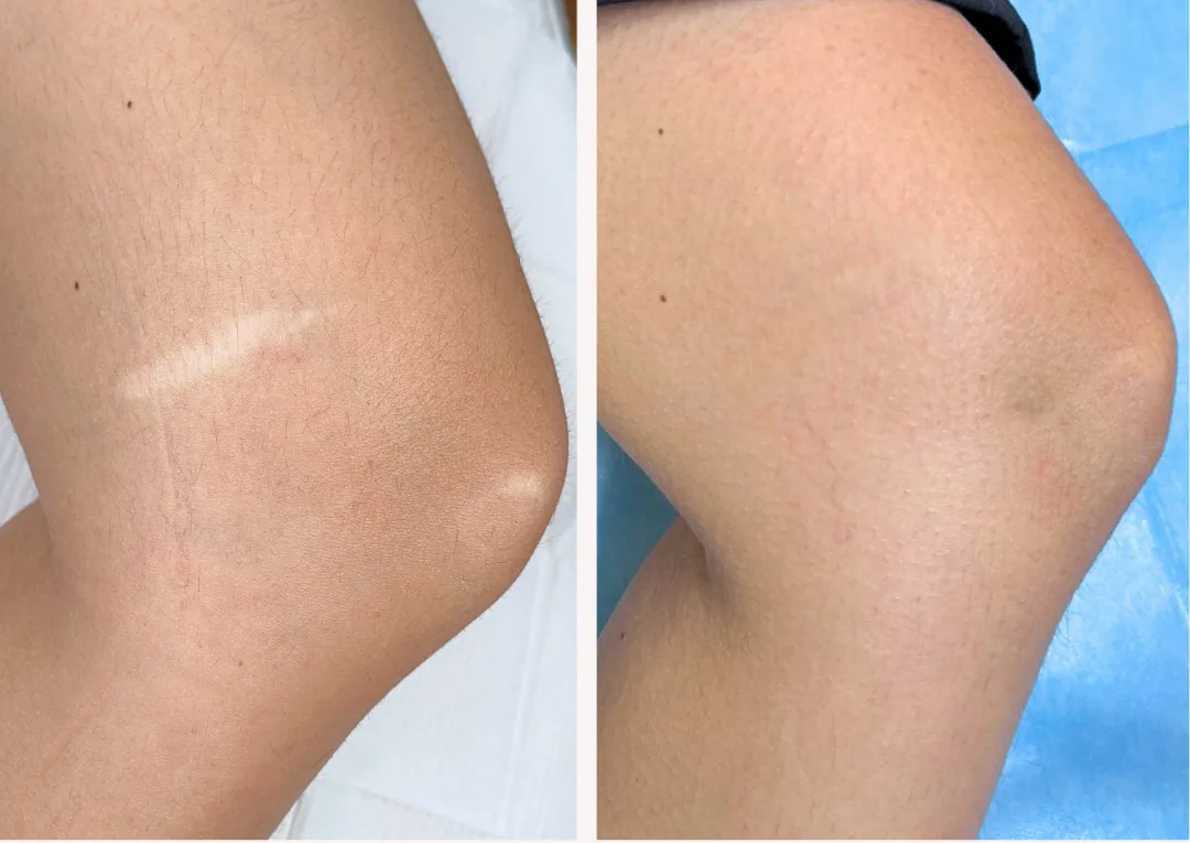What Is Paramedical Tattooing and How Does It Solve Common Skin Concerns?